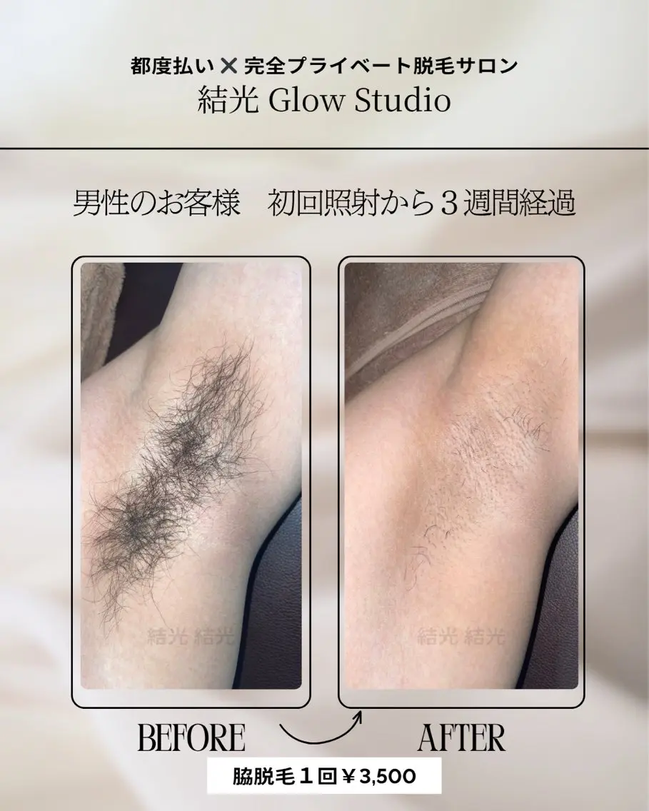 脱毛 結光Glow Studioのエステ・リラクイメージ