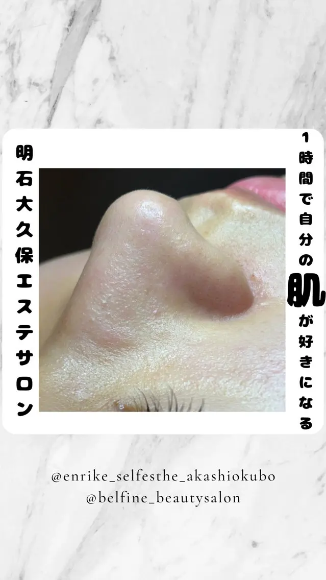 夕希 毛穴と脱毛特化サロンのエステ・リラクイメージ