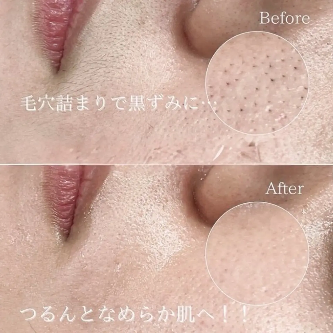 【📣練習モデル大募集】産毛・古い角質をオフ!化粧ノリ・トーンアップを即実感◎保湿ケア付き《フルフェイシャルWax》の写真