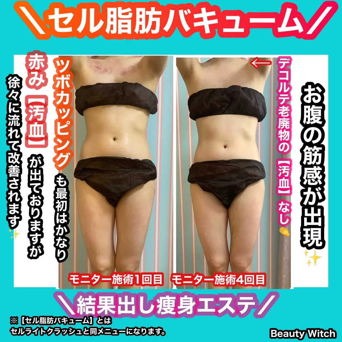 痩身/脱毛/ネイル HARUKAのエステ・リラクイメージ