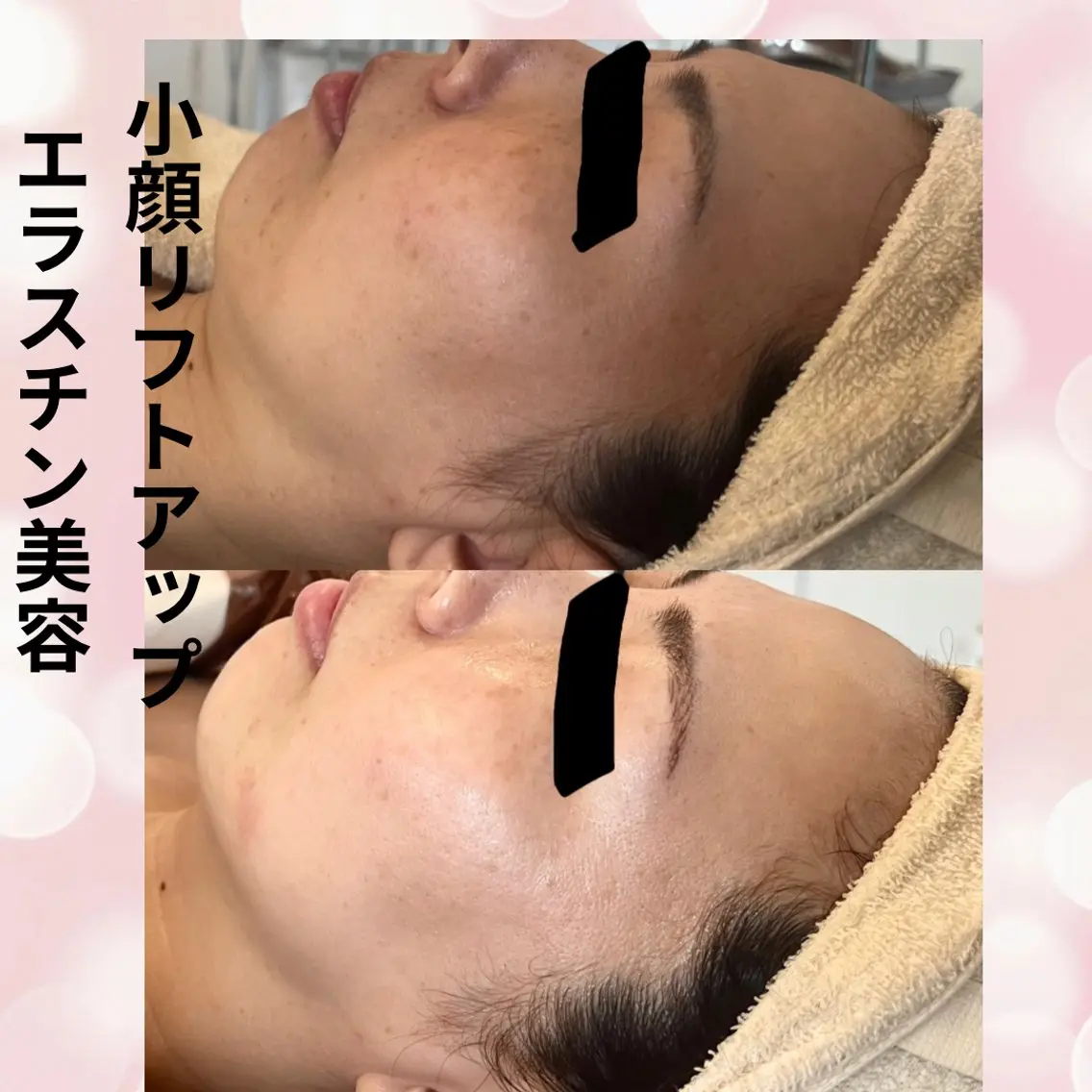 エステ beauty SalonRcoinのマツエク・マツパデザイン