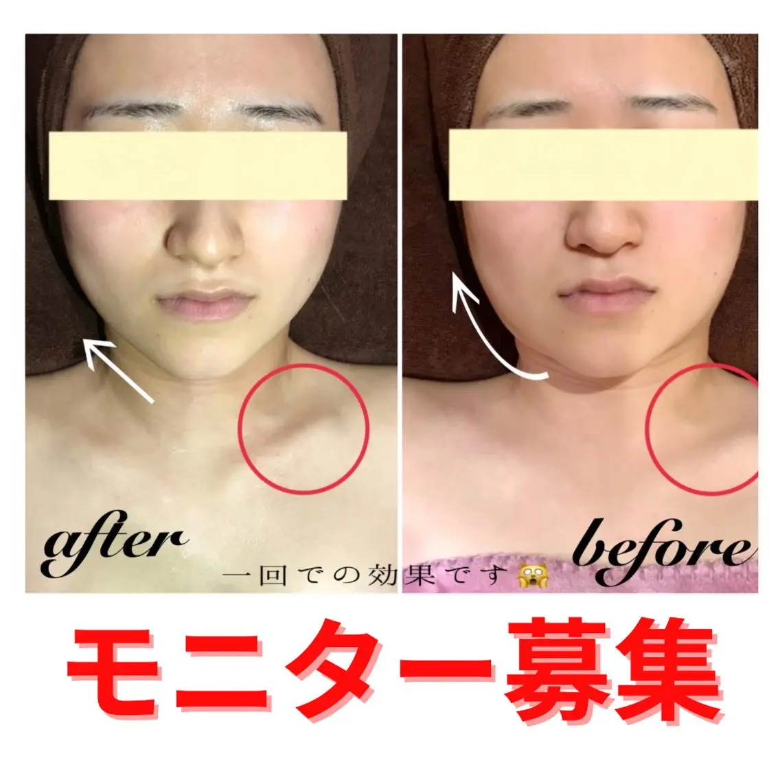 うなじ/もみあげ脱毛 ヴィシェーン佐藤のエステ・リラクイメージ