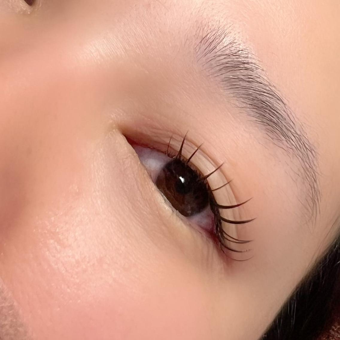 フラットラッシュ100本の写真