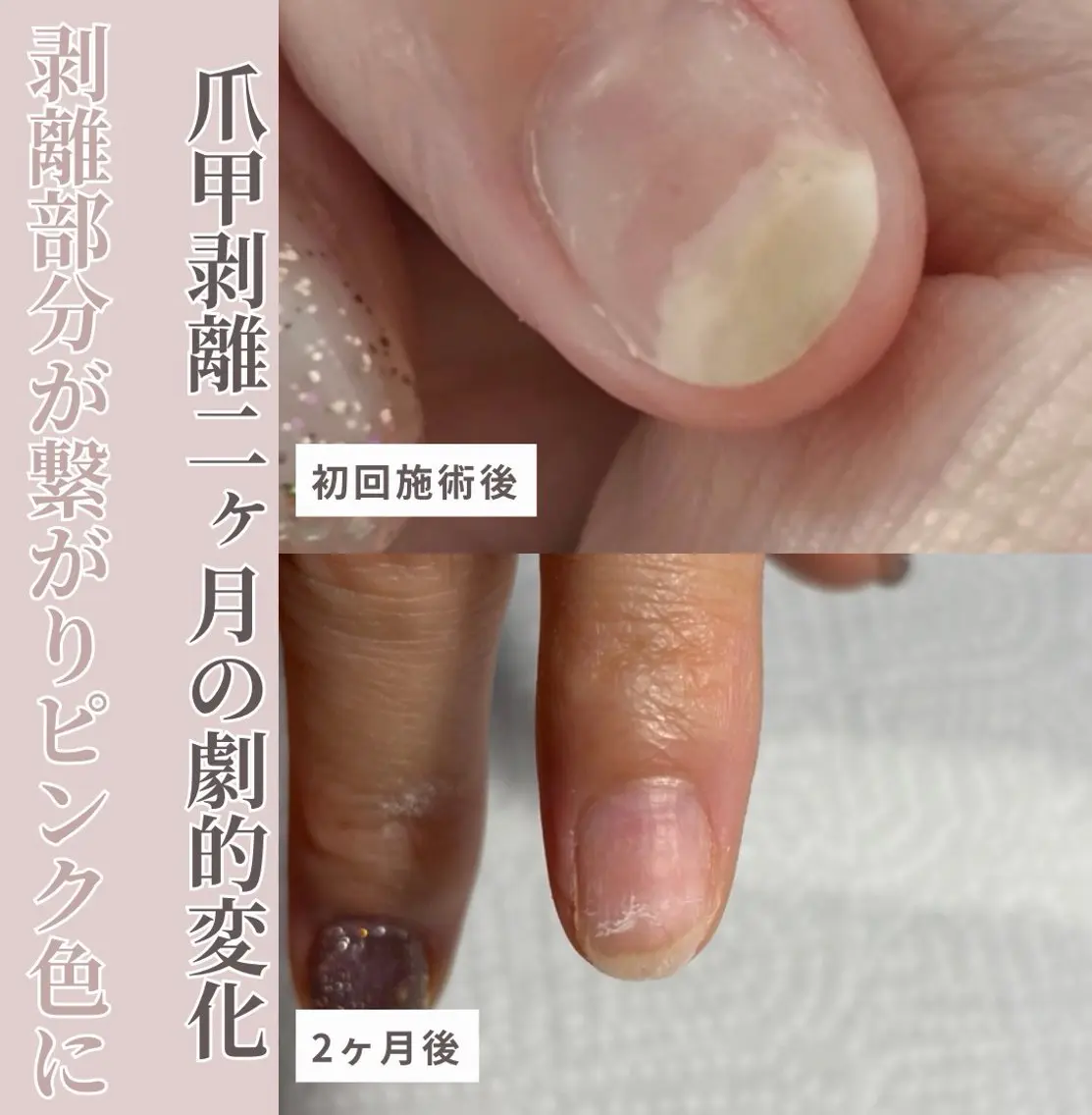 メンズ ネイル 卒業式 ハンドネイル ハンドケア Studio Jivanのネイルデザイン