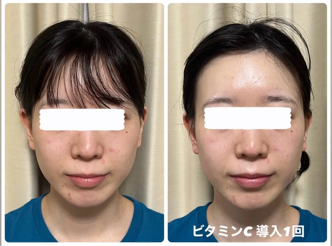 エステ 豊田 明里のエステ・リラクイメージ