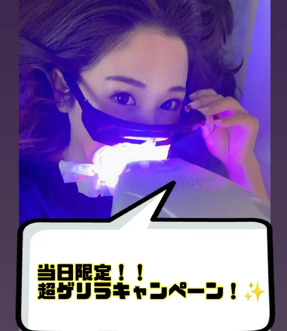 本日の空枠限定!新剤モニターで→ 当日利用のみのゲリラキャンペーン❗限定2名!初回セルフホワイトニング20分照射の写真