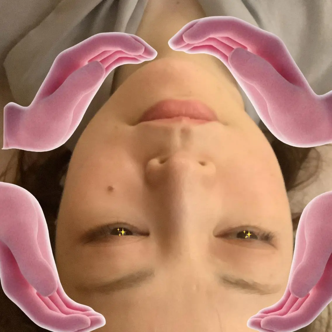 小顔造顔矯正の写真
