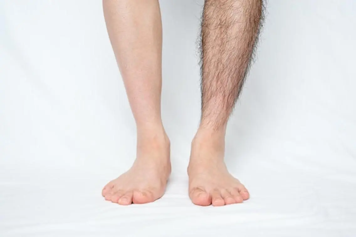※メンズ脱毛※脚全体(膝上、膝、膝下)の写真