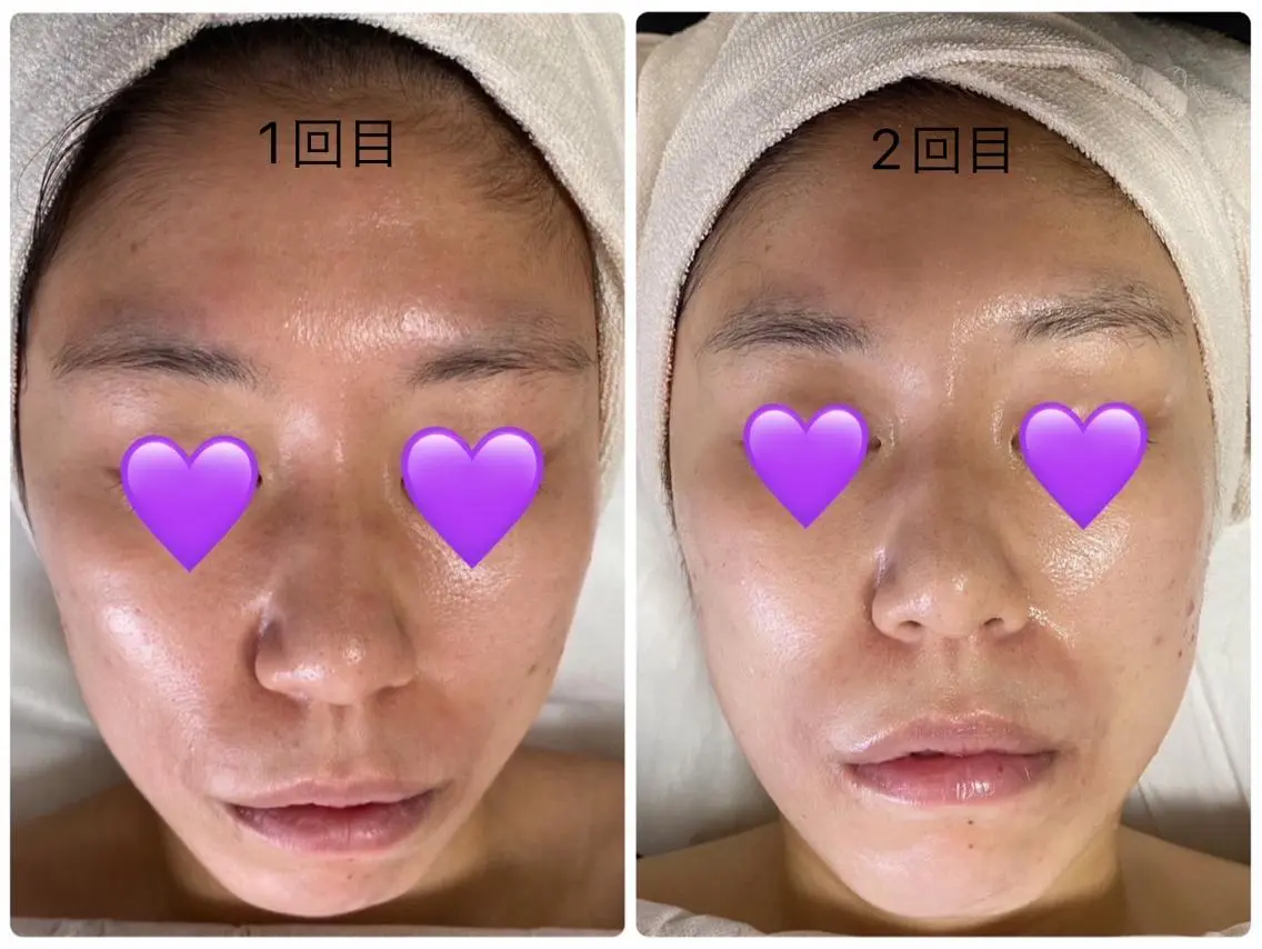 エステ COCO beautyサロンのエステ・リラクイメージ