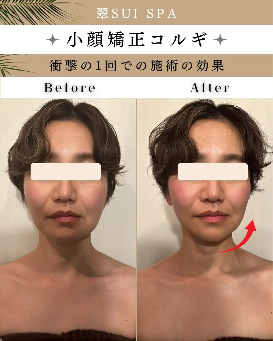 【リピート率NO.1🥇速攻リフトUP✨】 小顔矯正コルギ/首肩・リンパマッサージ付き💆♀️の写真
