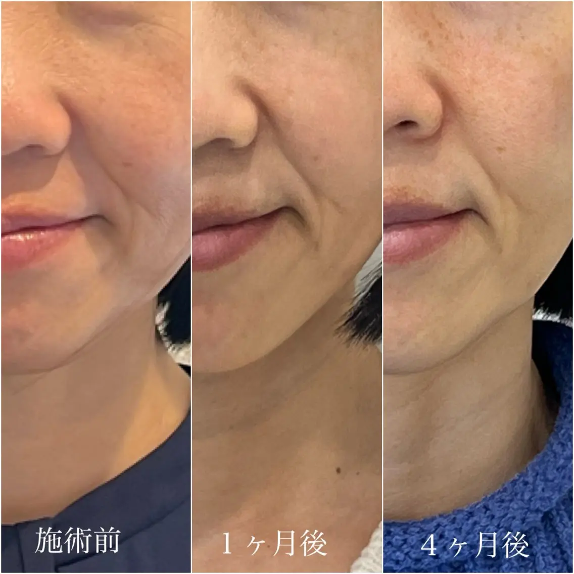エステ C's Beauté 【シーズボーテ】のエステ・リラクイメージ