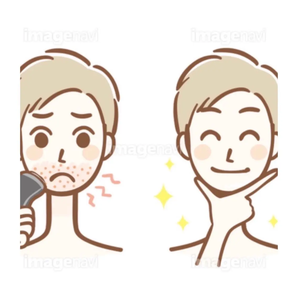 ★メンズエステ★Wメニュー男磨きは肌😙と髭🧔で決まり✨毛穴スッキリなめらかな肌と髭剃り🪒後の不快から卒業できる脱毛の写真
