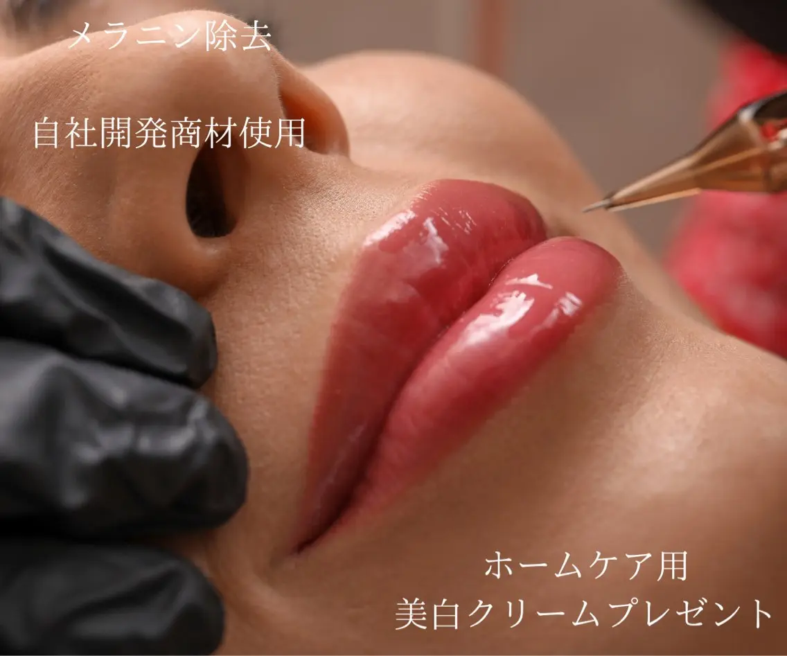 唇💋の黒ずみをメラニン除去の写真