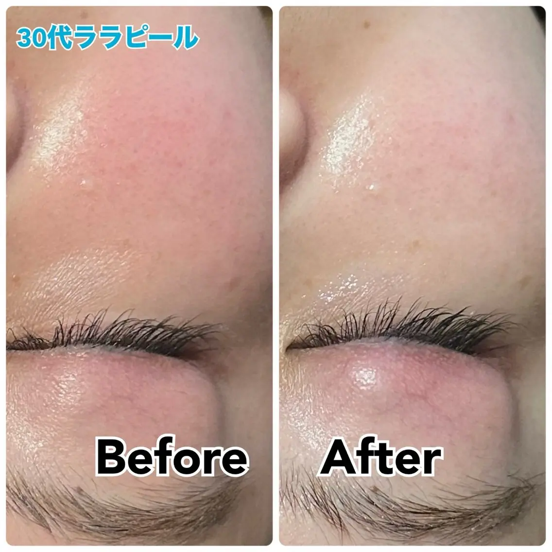 エステ 【毛穴・美白・美肌】 美・up 青葉台店のエステ・リラクイメージ
