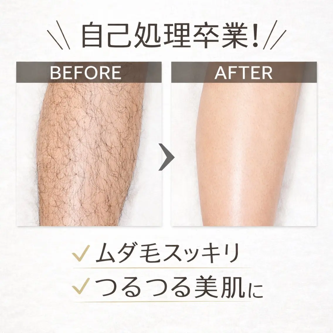 【店員おすすめ🌿】足全体脱毛(足甲指&お尻込み)の写真