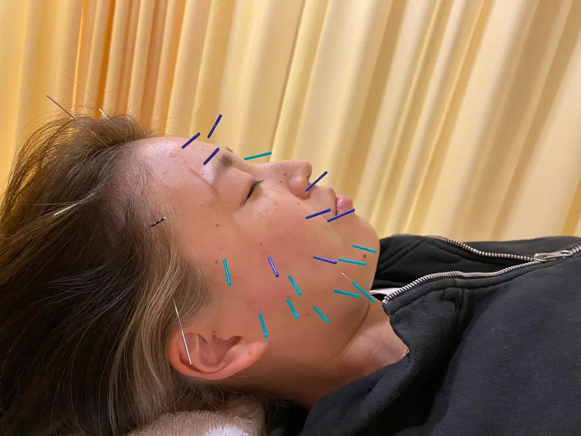 その他 鍼灸サロン BBB3のその他イメージ