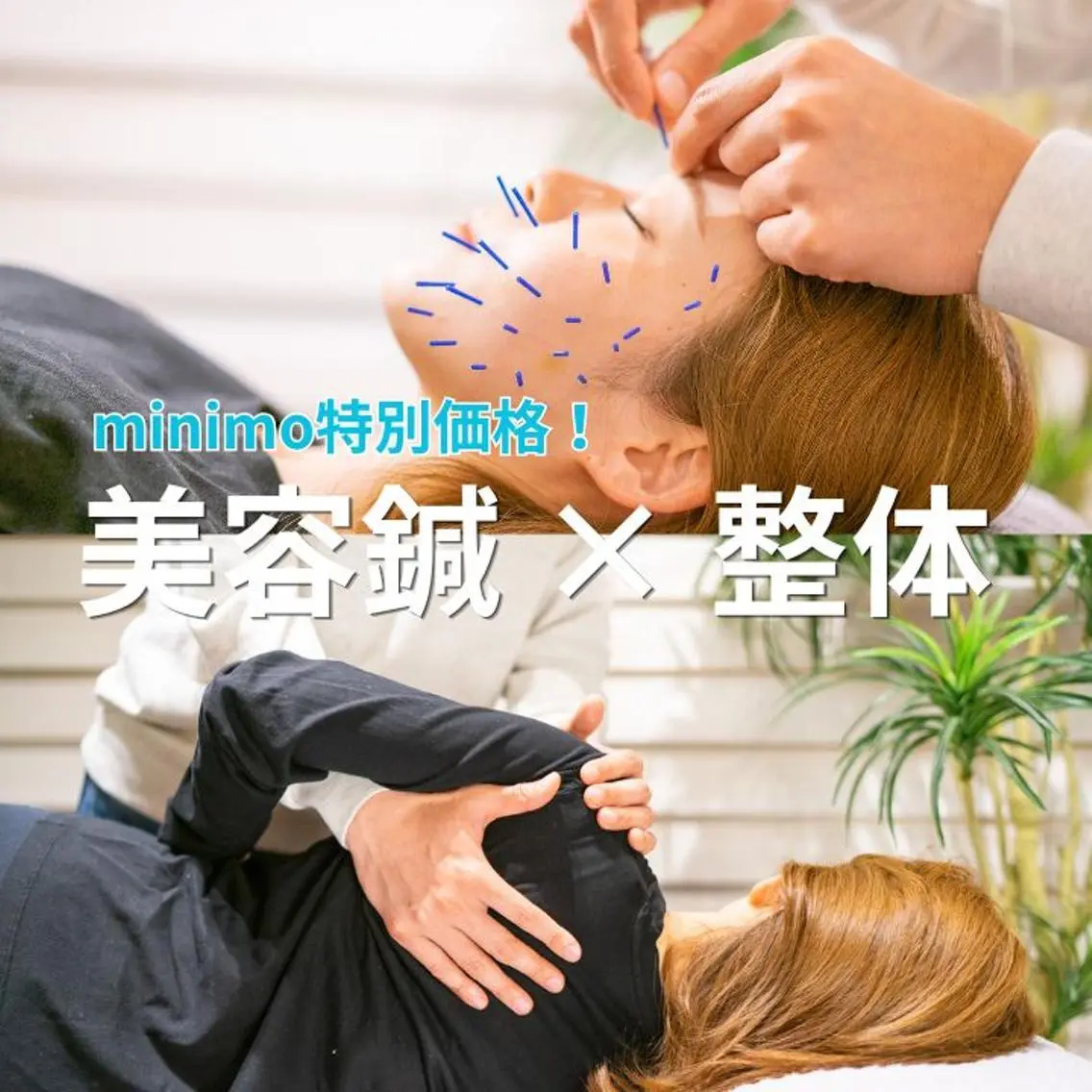 【全身リセット】鍼×マッサージで深部から整う!極上90分コースの写真