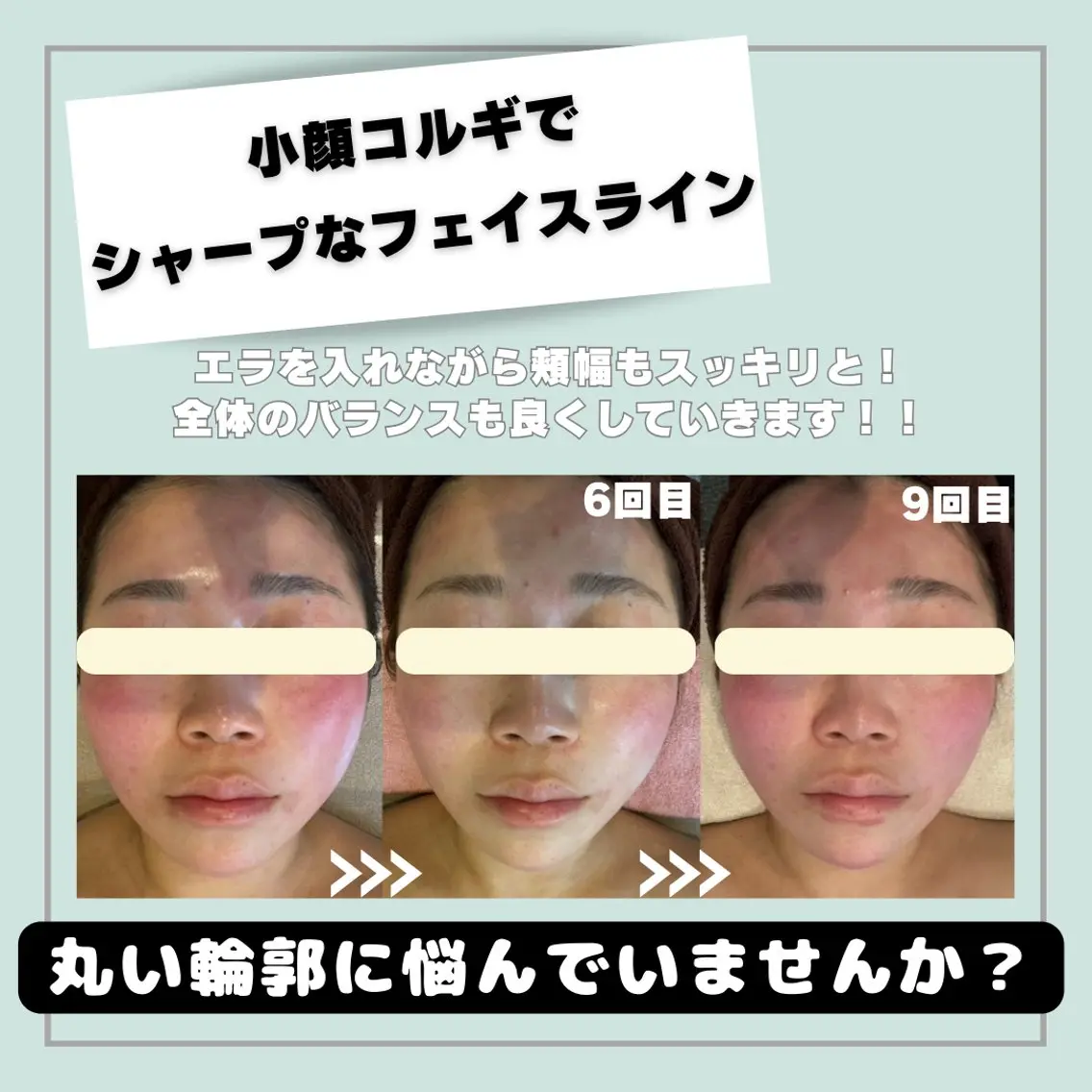 韓国肌管理HARRY ・ハリー🤍大村のエステ・リラクイメージ
