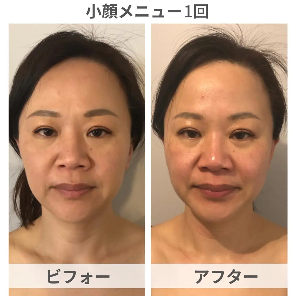 小顔.足痩せ整体 痩身天六Sunaoのエステ・リラクイメージ