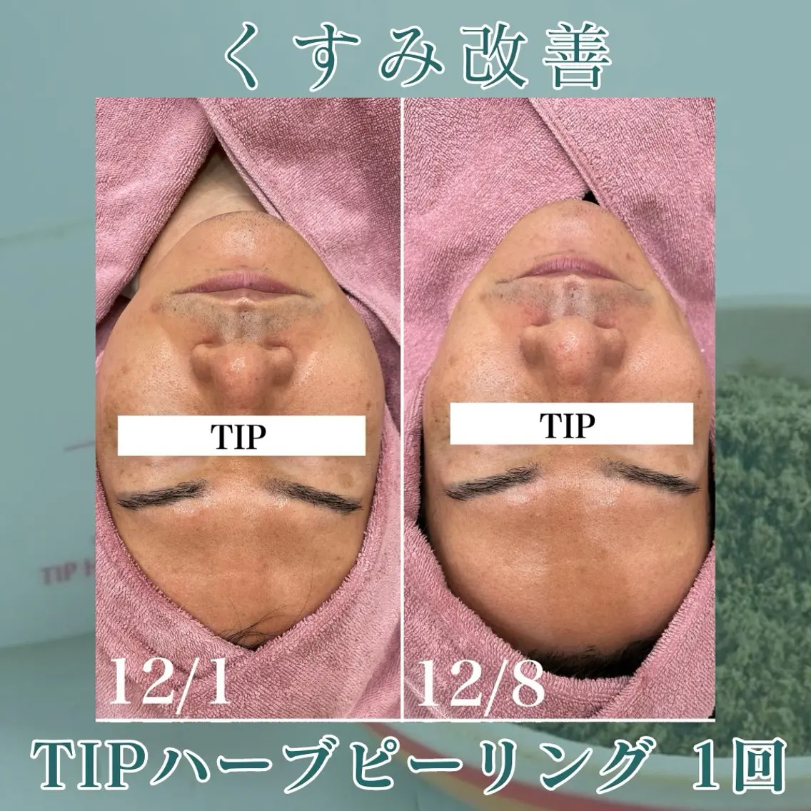メンズ エステ skin salon enのエステ・リラクイメージ