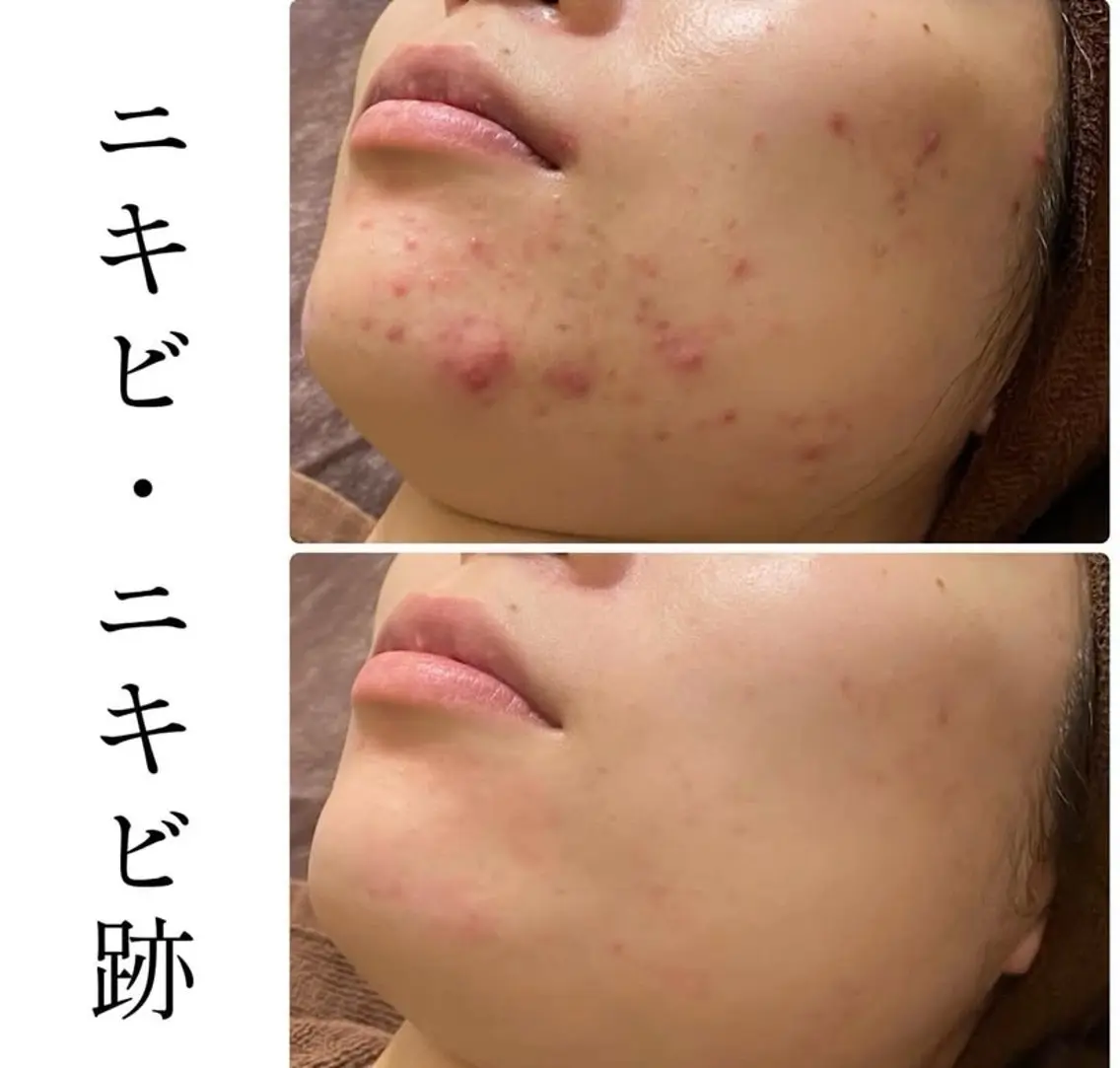 エステ ハーブピーリング専門 BIOPLUS+川崎のエステ・リラクイメージ