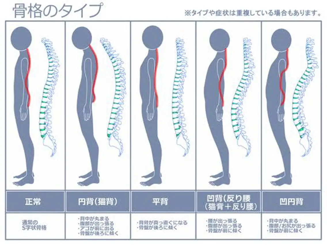 骨盤矯正+猫背矯正の写真