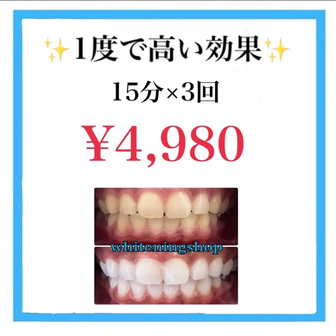セルフホワイトニング 15分×3回の写真