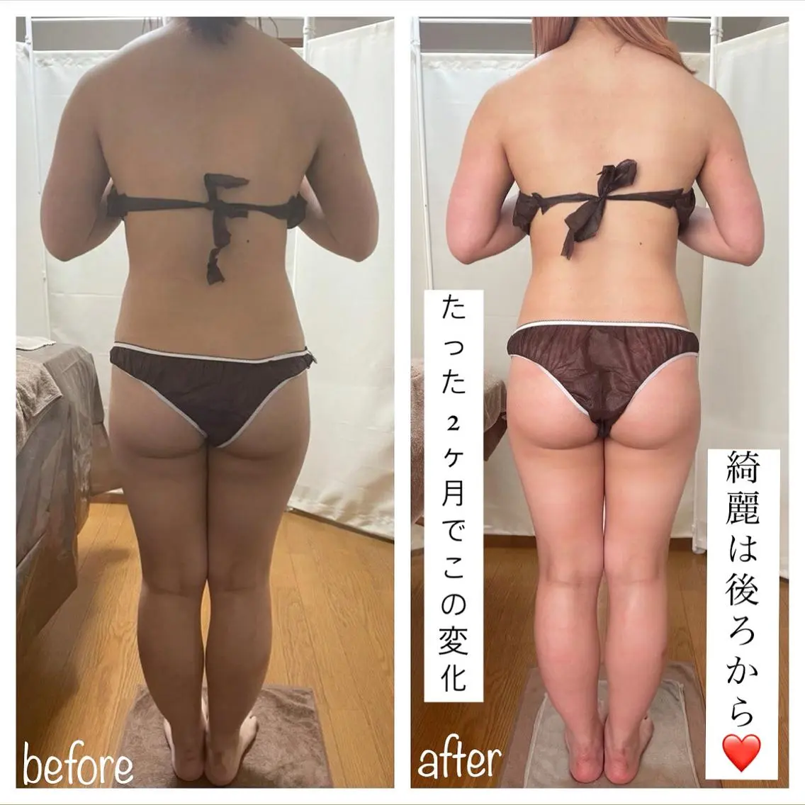 《本気痩せ×疲労改善 》 BILOOPのエステ・リラクイメージ