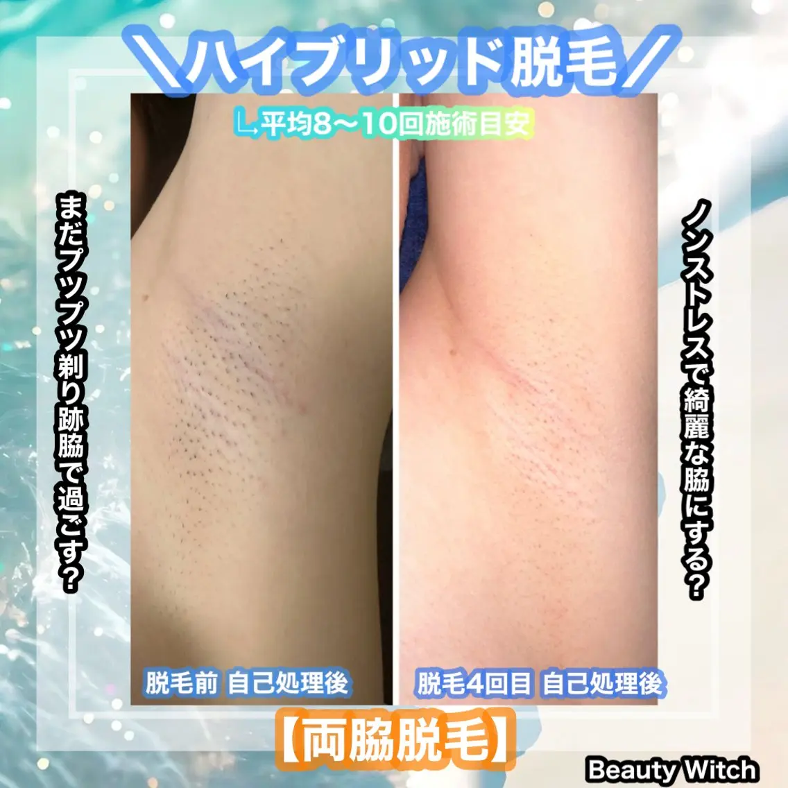 脱毛 痩身/脱毛/ネイル HARUKAのエステ・リラクイメージ