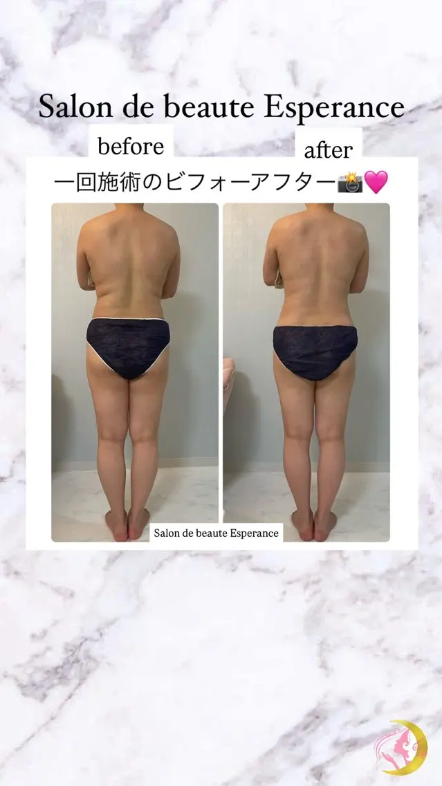 エステ リラク エスペランス 木下のエステ・リラクイメージ