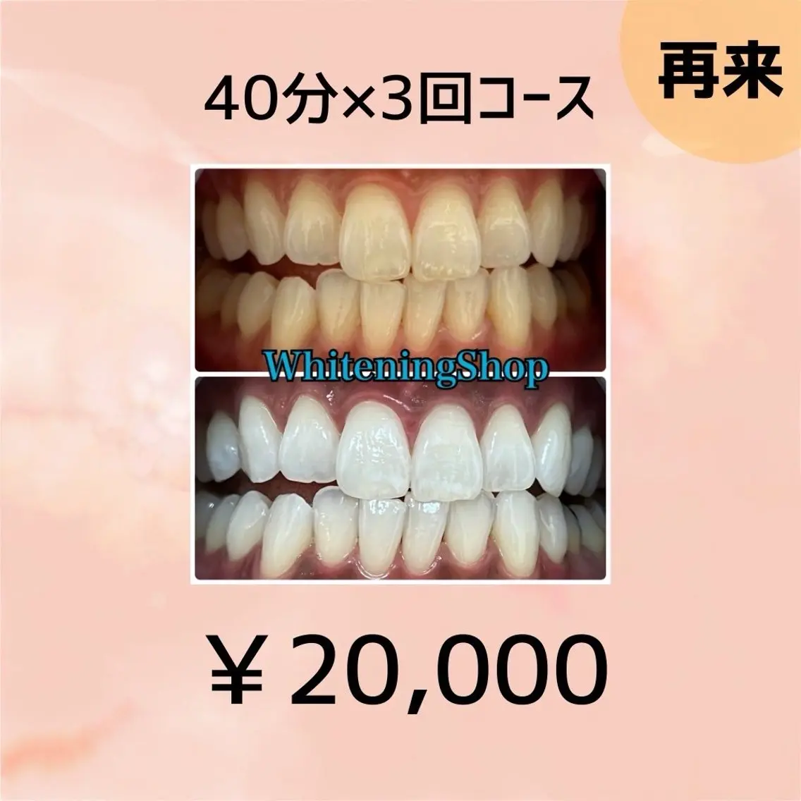 【2回目以降ご来店の方も回数券ご購入可能です🥰】40分×3回照射✨の写真