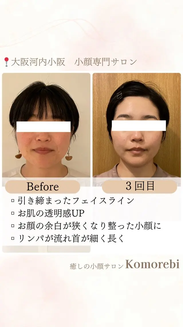 営業電話❌小顔サロン Komorebiのエステ・リラクイメージ