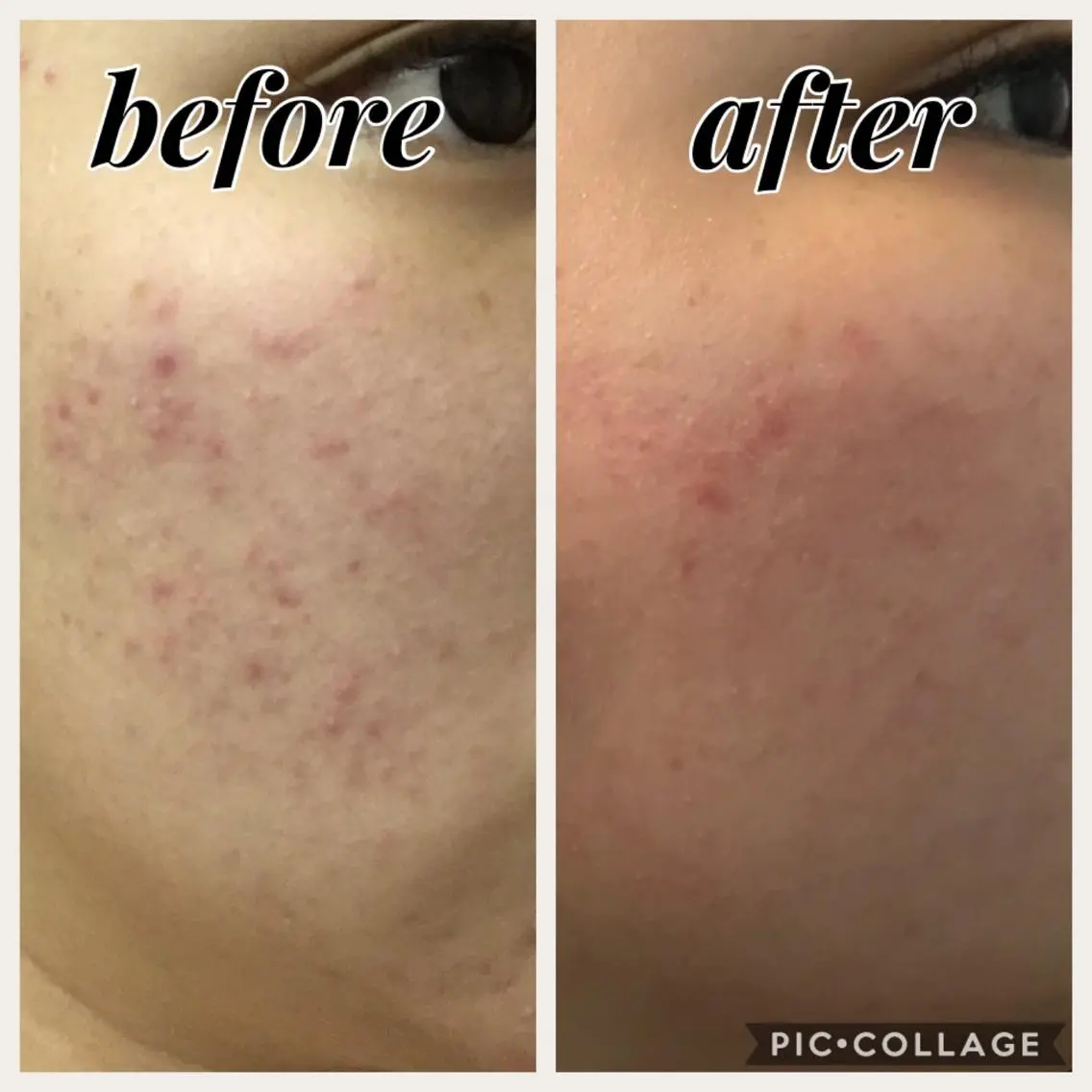 salon R 🌼Rieのマツエク・マツパデザイン