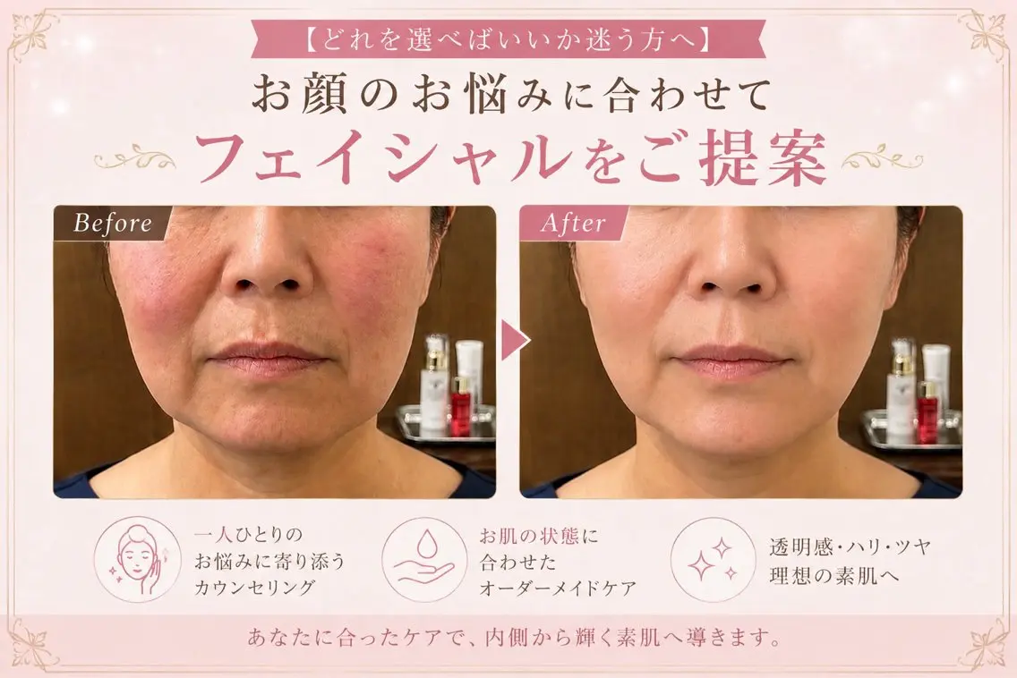 【どれを選べばいいか迷う方へ】お顔のお悩みに合わせてフェイシャルをご提案の写真