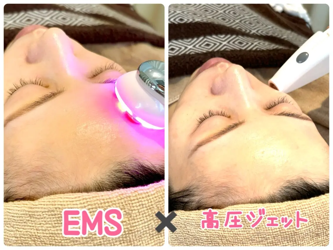 【小顔・むくみ・たるみ・小じわに✨】EMS全顔+特許取得の最新機器✨高圧ジェットで真皮までダイレクト注入💆♀️の写真