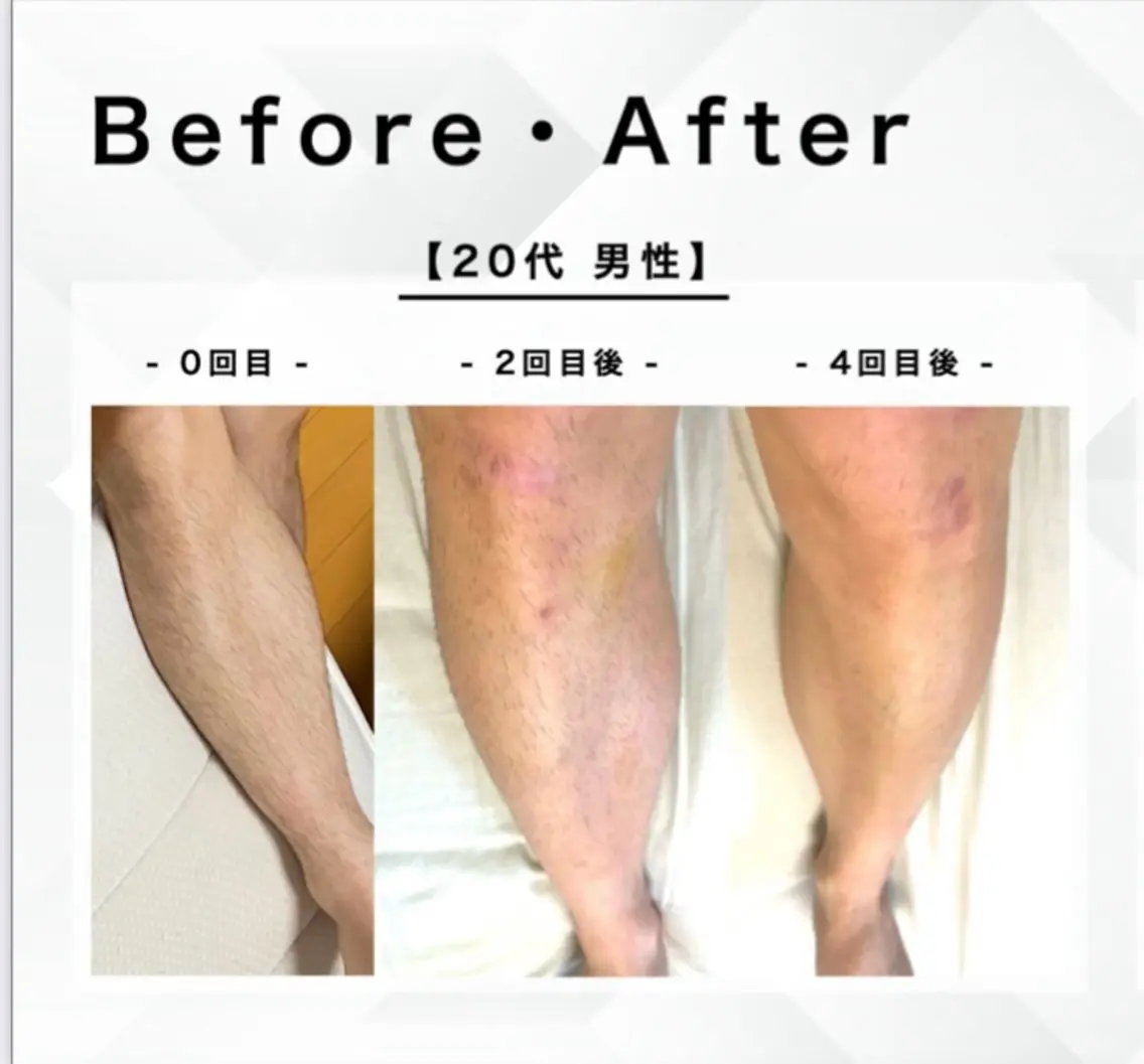 メンズ esthesalon O'-en-のエステ・リラクイメージ
