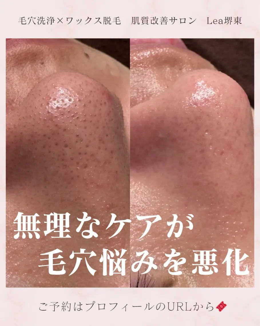 エステ Lea堺東　　眉毛| 毛穴洗浄|顔WAXのその他イメージ