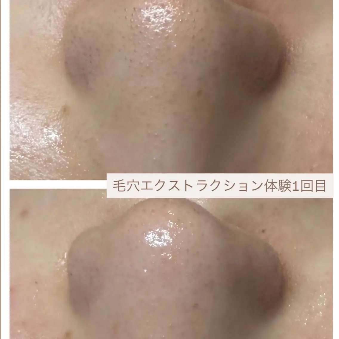 エステ uni. abeのエステ・リラクイメージ