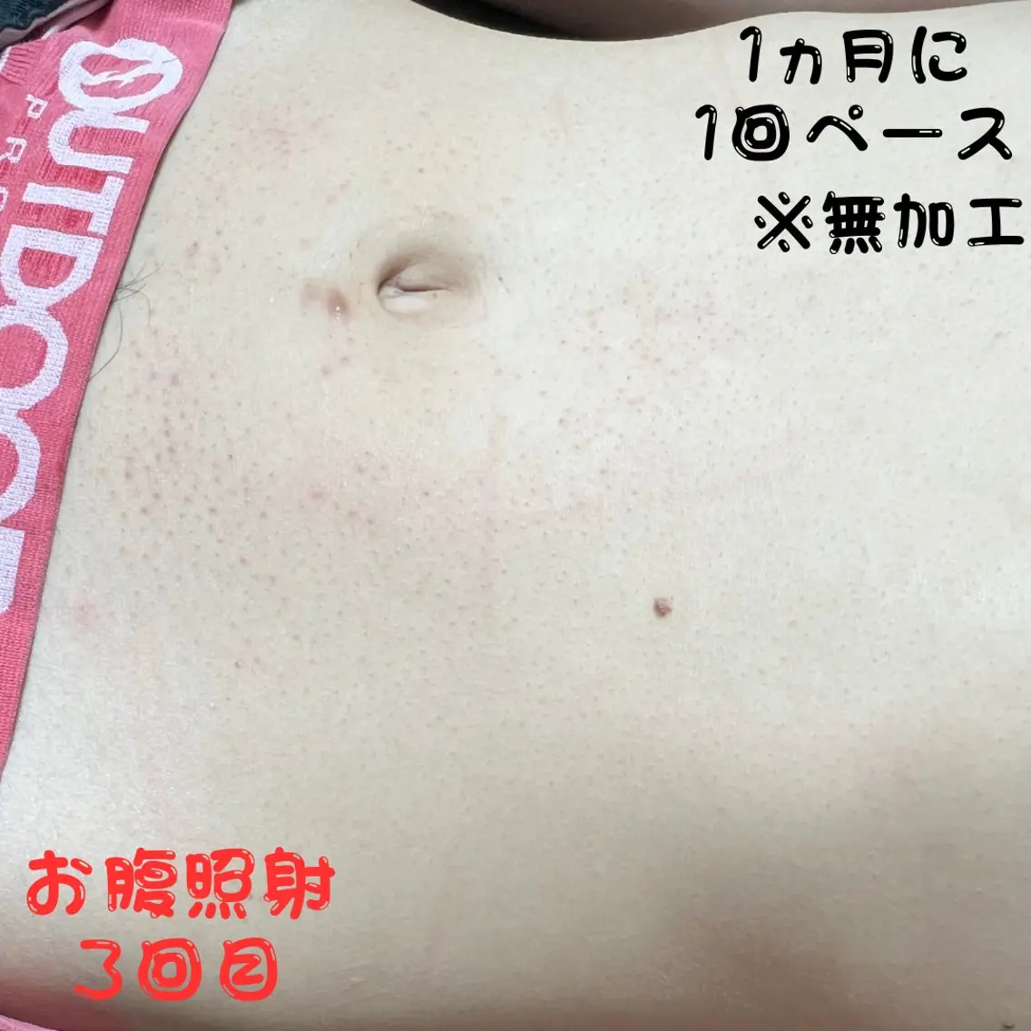 メンズ キッズ 脱毛 メンズ脱毛フェリッセ /男女🆗キッズ🆗のエステ・リラクイメージ