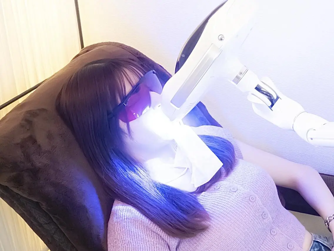 【サブスク定額プラン💎】セルフホワイトニングハイパワー5分照射🦷の写真