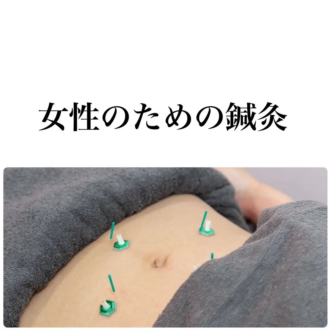 【期間限定!妊活鍼灸】血流促し、子宮・卵巣にアプローチの写真