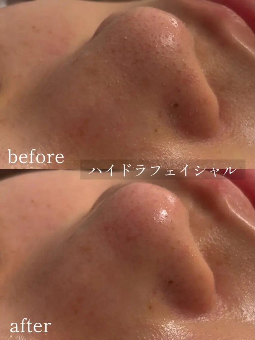 saron Mのエステ・リラクイメージ