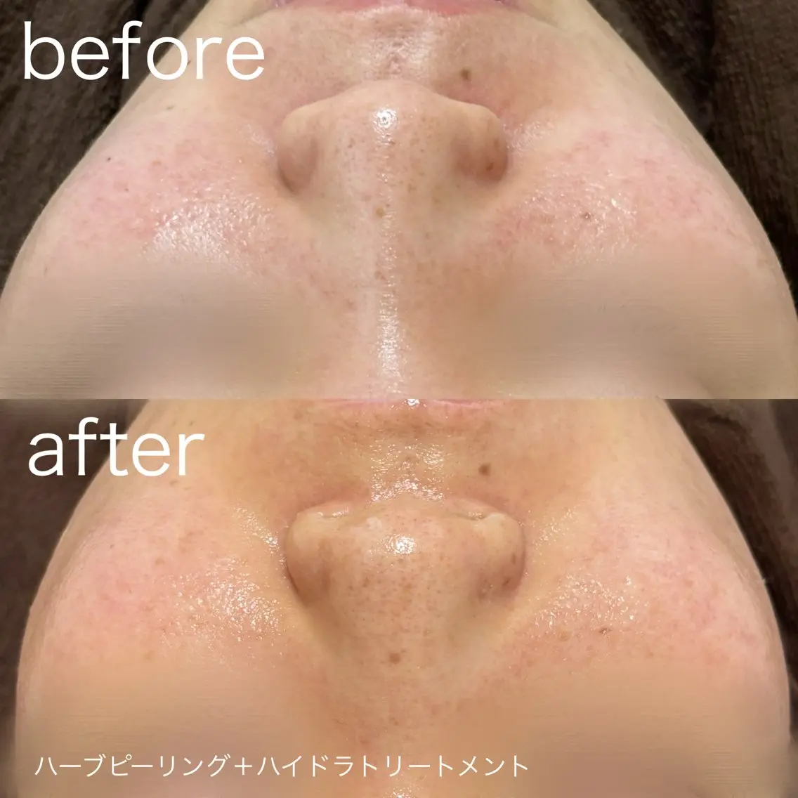 その他 lulularico Yuのネイルデザイン