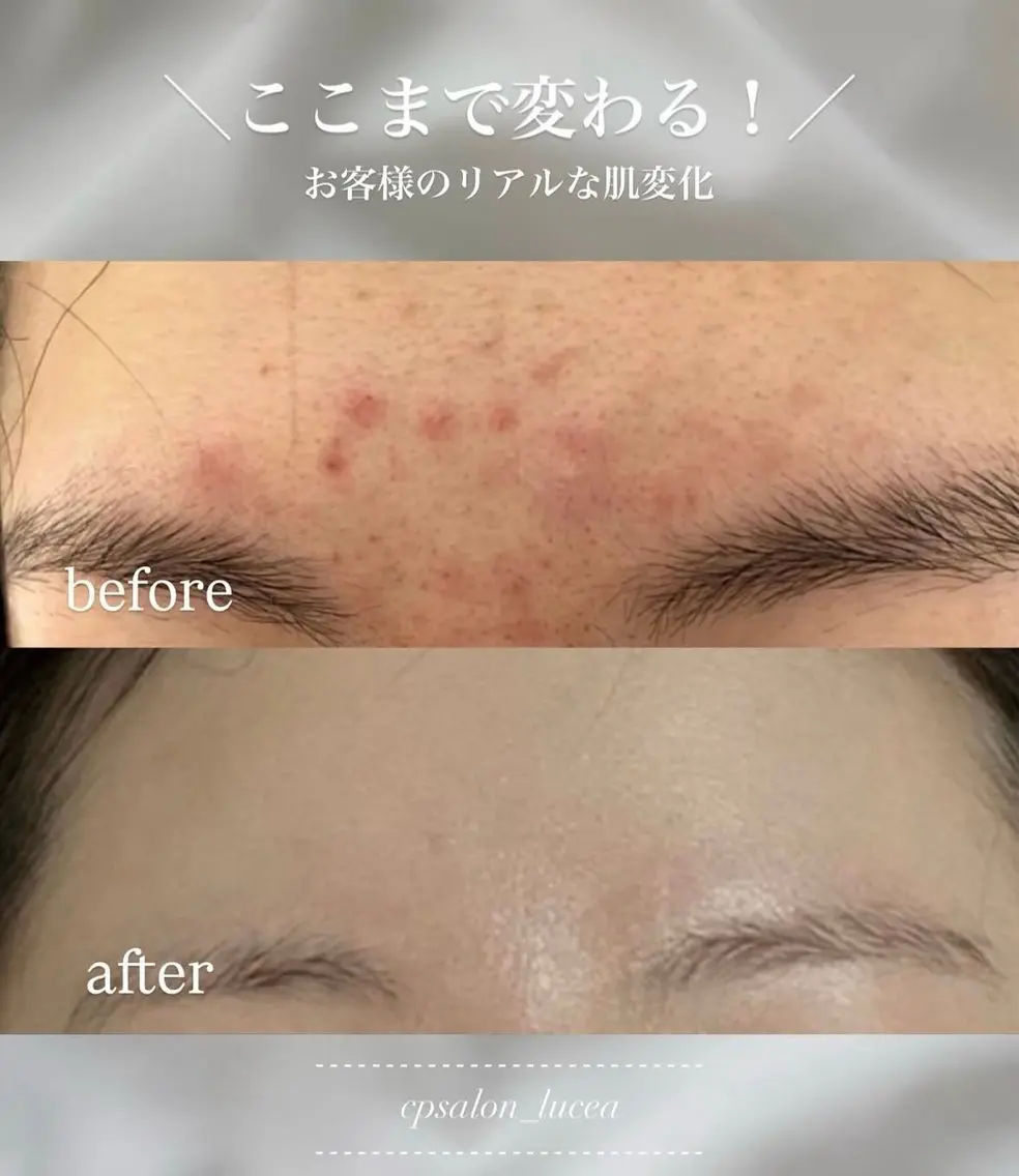 CPサロン Luceaのエステ・リラクイメージ