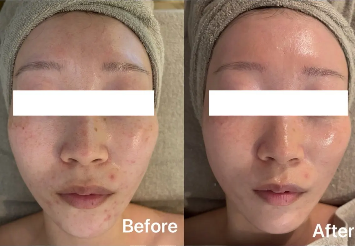 facial salon D 吉沢のエステ・リラクイメージ