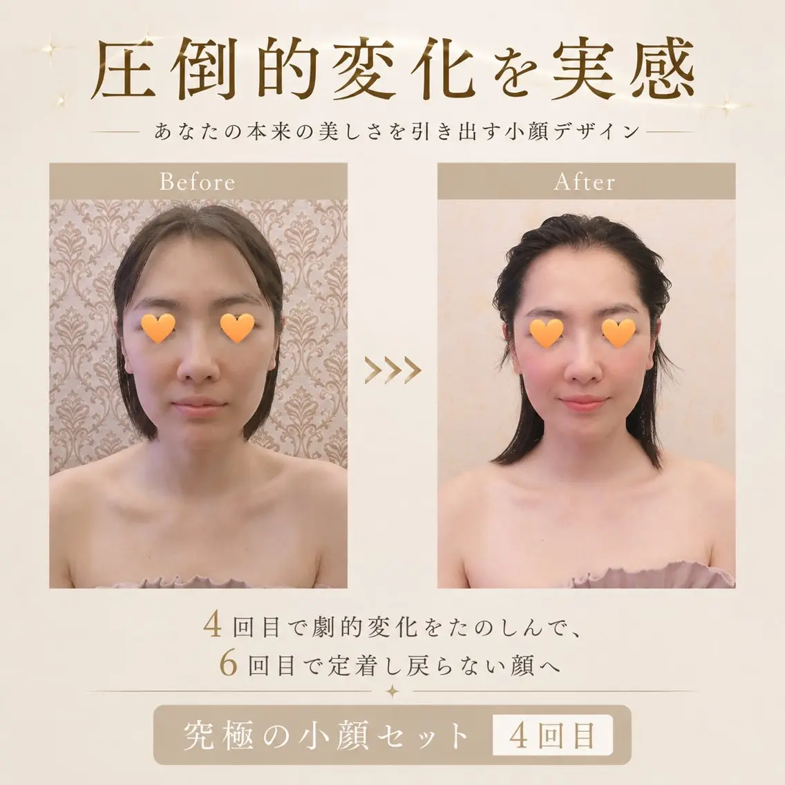 人気No.１🌿究極の小顔セット初回メニュー🌿　骨入れデザイン小顔矯正➕小顔リンパがセット　コンプレックスある方必見！の写真