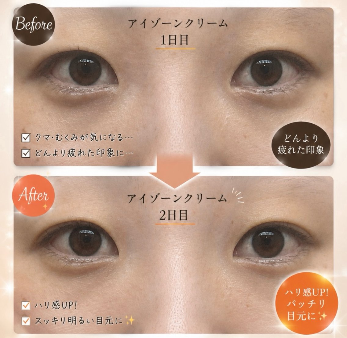 目元のクマ、重さ解消！目元ぱっちりパック＋目元マッサージ＋無料フェイシャルマッサージ💆‍♀️🫧の写真