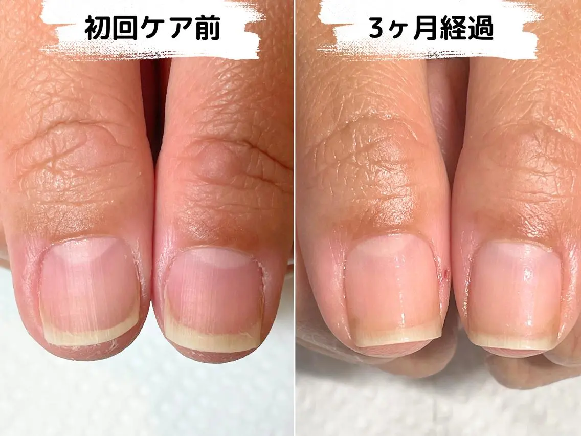 ネイル ハンドケア 自爪育成専門店 Kapilinaのネイルデザイン