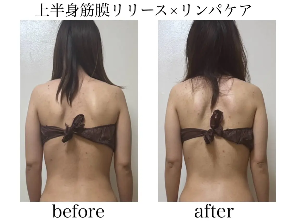 【30日以内にご来店のリピーター様限定10%オフ】上半身筋膜リリース×リンパケアの写真