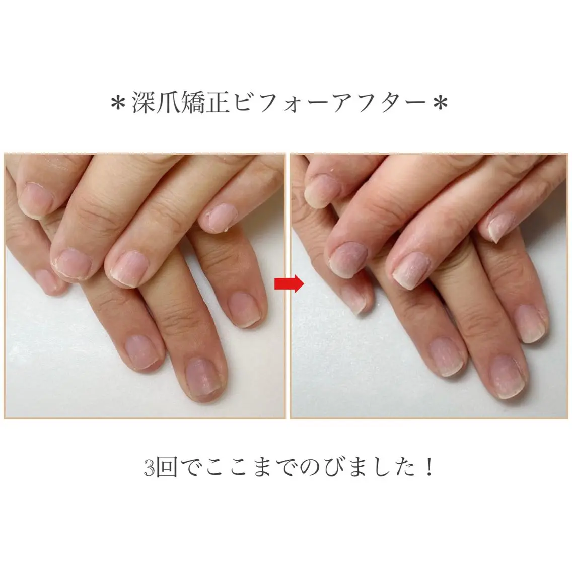 ネイル ネイルサロン アリュームのネイルデザイン